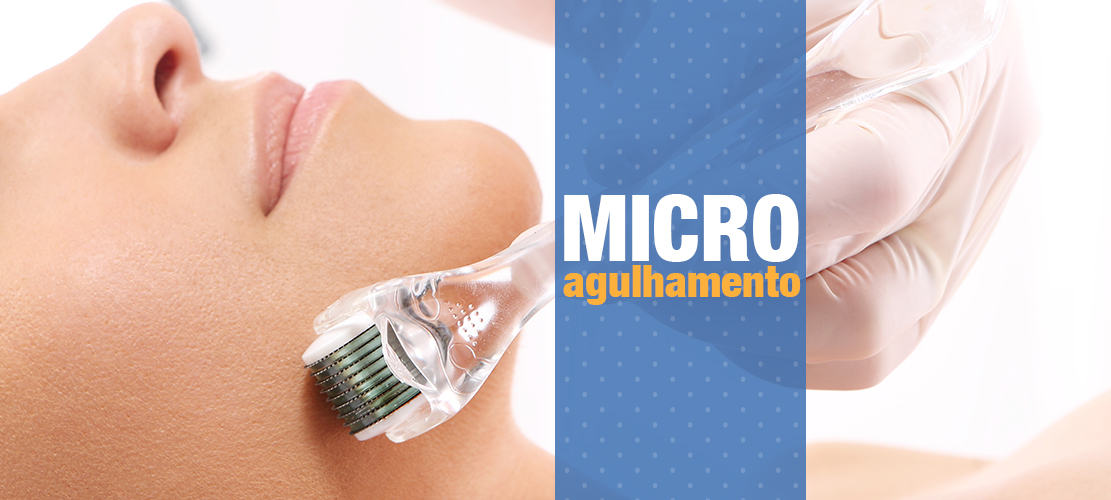 Microagulhamento – Novidade para tratamento de pele!